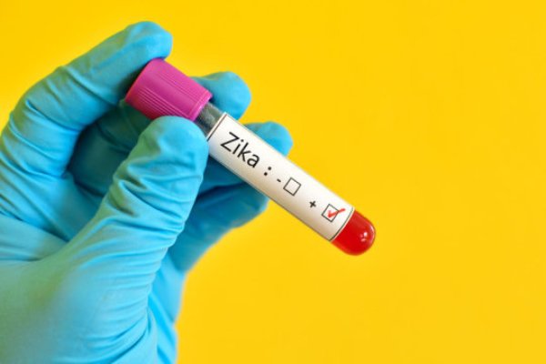 An analysis has shown 100% genetic correlation between the form of the virus present in a man who contracted the virus in Brazil and that of a woman who had never travelled in the epidemic area, but who had sexual relations with him.