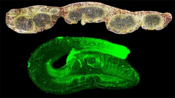 Lymph node follicles (top) and the intestinal worm Heligmosomoides polygyrus bakeri (bottom).