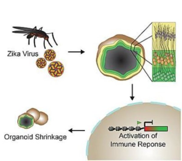 In a 3-D brain model, Zika virus activates immune receptor TLR3, which in turn inhibits brain cell development and survival, causing the organoids to shrink -- an effect reminiscent of microcephaly.