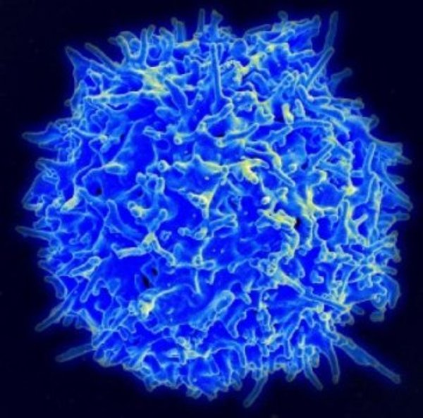 A human T-cell.