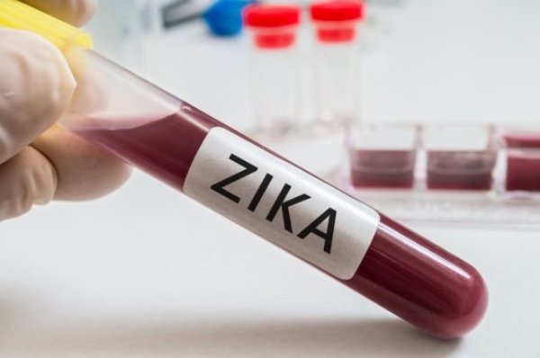 Zika can be spread by infected mosquitos or through sexual intercourse. In adults, the symptoms are generally mild and include fever, rash, joint pain, and red eyes. However, Zika virus can cause a serious birth defect called microcephaly, and other severe neurological effects such as eye problems, hearing loss, and impaired growth in infants born to women who contracted the virus when pregnant.