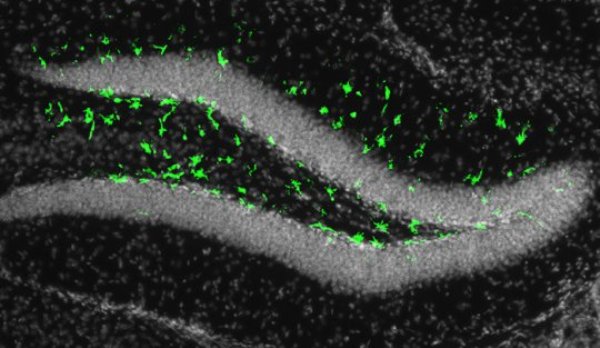 Zika in the adult brain: Illumination of the fluorescent biomarker in green revealed that Zika can infect the adult mouse brain in a region full of neural progenitor cells, which play an important role in learning and memory.