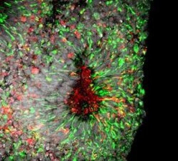 This image shows Zika virus infection in cell death in human forebrain organoids.