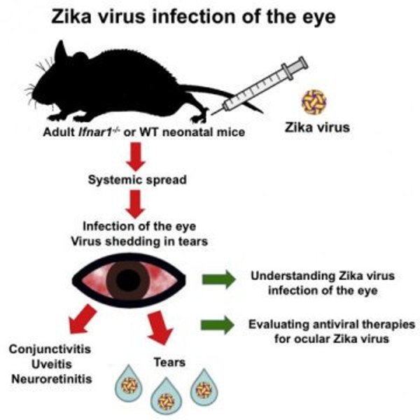 This visual abstract the findings of Miner et al., who describe how ZIKV infection in the eye results in inflammation and injury. ZIKV infected the iris, cornea, retina, and optic nerve and caused conjunctivitis, panuveitis, and neuroretinitis in mice. This manuscript establishes a model for evaluating treatments for ZIKV infections in the eye.