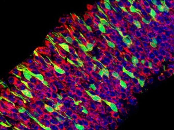 In mice with several different genetic forms of microcephaly, stem cells (shown in red or blue) die off before they can divide and become mature neurons (green). Too much of a protein called p53 is at least partly responsible for underdeveloped brains in each of the mouse models, finds a new study.
