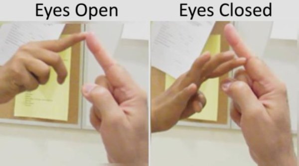 Unlocking the mysteries of our senses: An NIH Study shows that two young patients with a mutation in the PIEZO2 have problems with touch and proprioception, or body awareness
