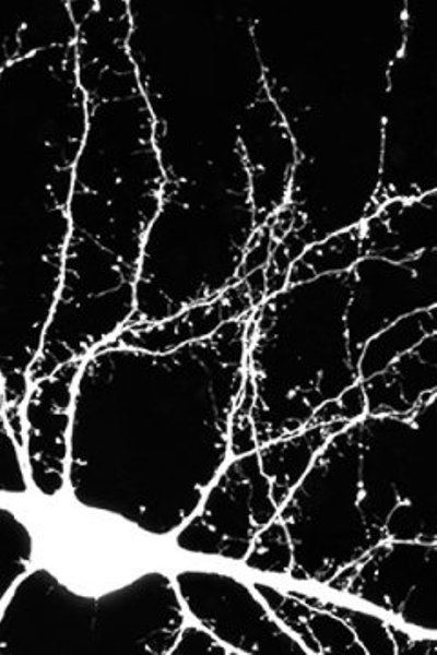 Brain cells form connections with their neighbours on hairlike growths that sprout from a cell's branching arms (pictured here). These connections are important for learning. In individuals with Autism, the number of connections is not correct, which causes problems for individuals to form new memories and develop social skills.