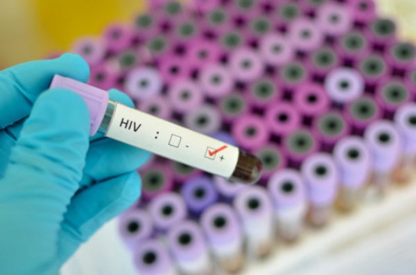 Combining an experimental vaccine with an innate immune stimulant may help lead to viral remission in people living with HIV.