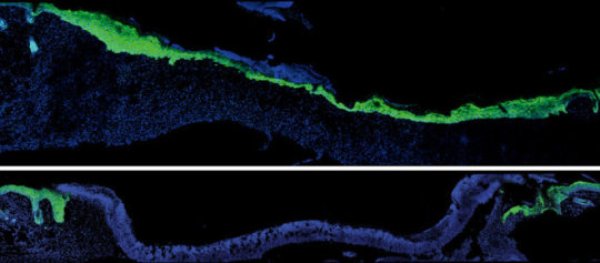 Five days after an injury to young mouse skin (blue), new skin cells (green) fill the wound (top). When researchers turned down expression of a protein skin cells use to talk to nearby immune cells, new skin took much longer to arrive (bottom).