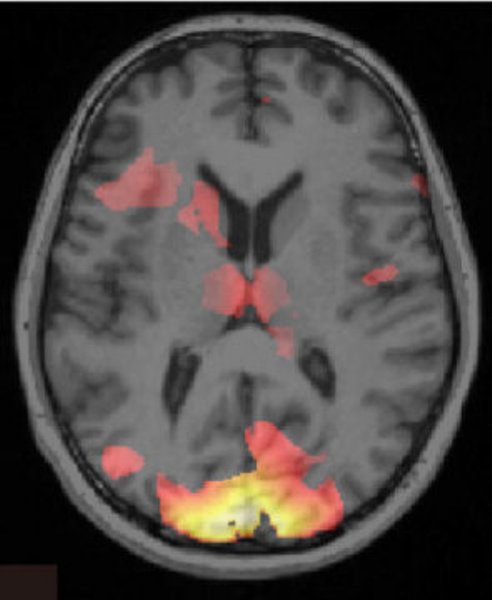 Scan of brain showing information associated with a fear memory.