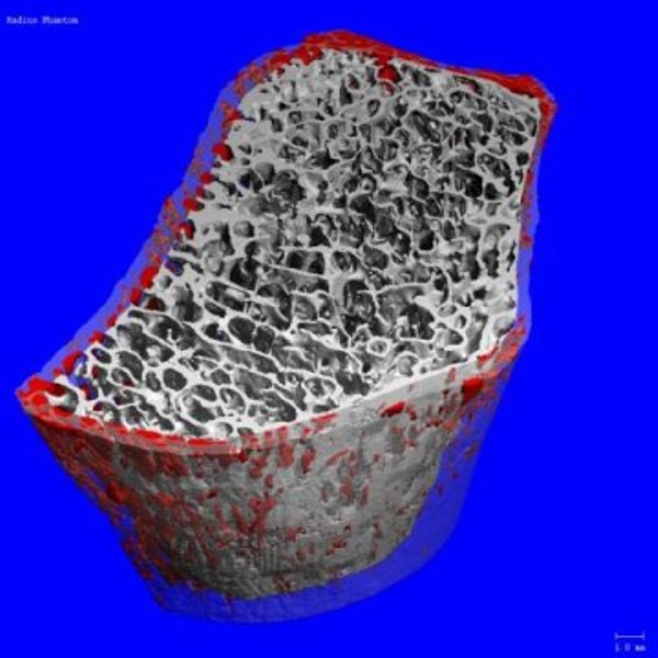 Image acquired using a SCANCO Medical XtremeCT scanner.