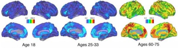 The older age group experiences a dramatic increase in the number of groups of closely related activity that each brain region belongs to. This is reflective of the overall increase in the number of these groups with age.