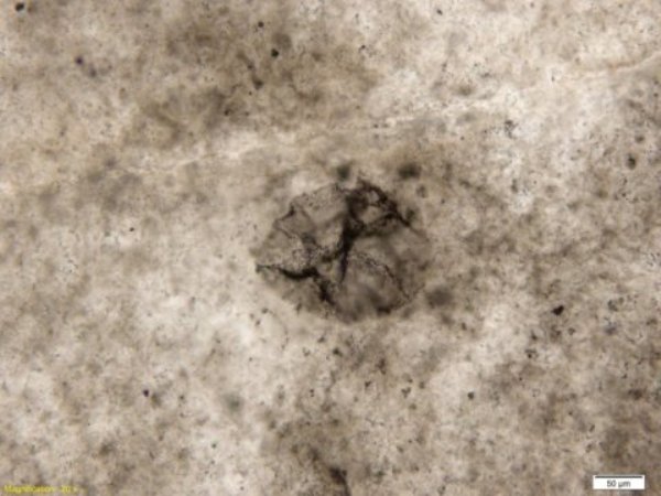 This is a microscopic image of 2.5 billion-year-old sulfur-oxidizing bacterium.
