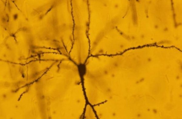 This is a pyramidal neuron.
