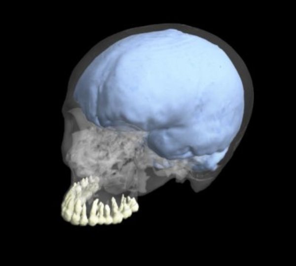 This is a 3-D reconstruction of a modern human cranium showing the teeth and endocranial cast.
