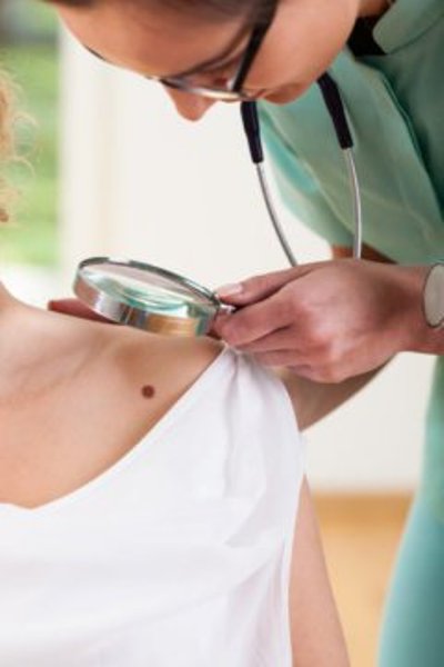 Checking for melanoma.