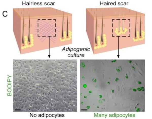 This is a comparison of wounds healing with and without hair follicles.
