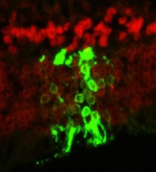 Image showing transplanted GFP-expressing human stem cell derived photoreceptors integrated in a host rodent retina stained for Otx2 in red.