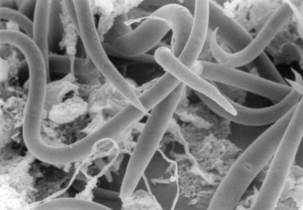 Antarctic nematode worms photographed under the microscope.