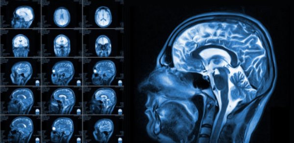 New research could lead to ways of enhancing cognitive function to counteract the effects of diseases such as Alzheimer's and schizophrenia, as well as enhancing memory in healthy people.