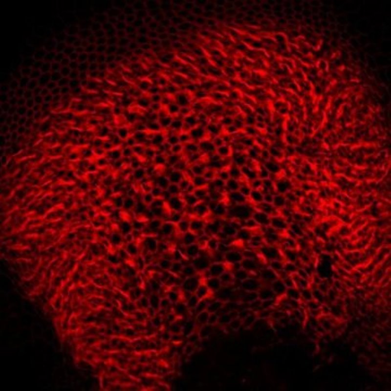 Scientists have developed a new way to deliver genes into the hair cells of the inner ear in mice.