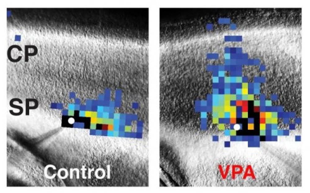 These images of mouse brains compare laser scanning photostimulation maps of all the neurons connected to one central neuron in control mice (left) vs. mice dosed with valproic acid (VPA) to induce autism-like symptoms (right). The researchers focused on neurons in the subplate (SP) region, directly below the developing cortex (CP, or cortical plate), which controls perception and behavior. The central neuron is marked in white, and each colored square represents a neuron that has a direct synaptic connection to the central neuron. Reds and oranges represent stronger connections compared with greens and blues, indicating that subplate neurons in VPA-treated mice form numerous strong connections early in development.