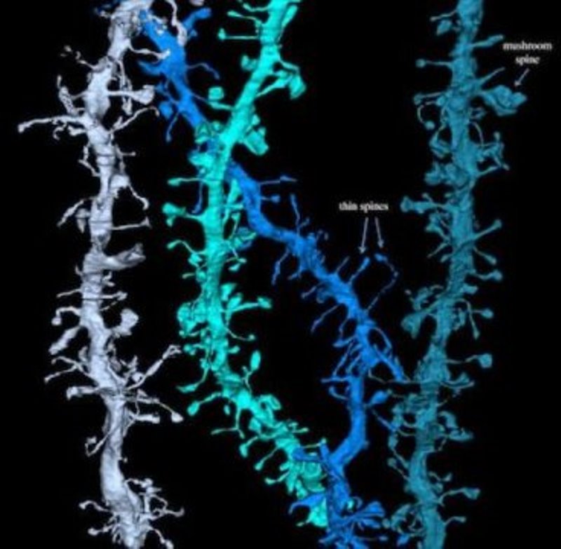 This picture shows 3-D reconstructions of electron microscope images of tree branch-like dendrites. At the end of the branches are cup-like structures called the spines, and in the tips of the spines are synapses. By studying thousands of images like these, the Wisconsin researchers showed that the synapses shrink after the mouse sleeps and grow again during the next wakeful period.