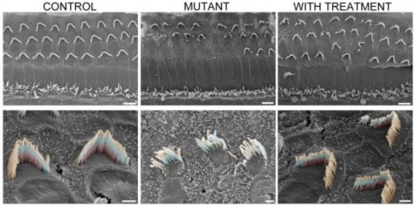 Unaffected mice, at left, have sensory hair bundles organized in 'V' formations with three rows of cilia (bottom left). This orderly structure falls apart in the mutant mice (middle column), but is dramatically restored after gene therapy treatment.