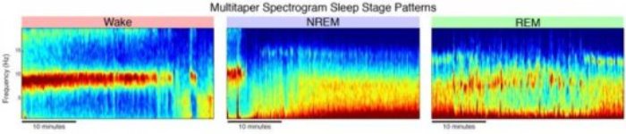 The sleep EEG multitaper spectrogram reveals patterns of continuous changes in brain oscillation activity during sleep. Characteristic patterns clearly differentiate waking (left) from nonREM (center) and REM sleep (left).