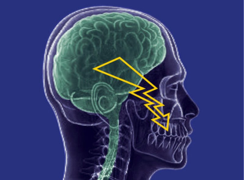 Trigeminal neuralgia: A glimmer of hope for patients – thanks to a newly tested substance.