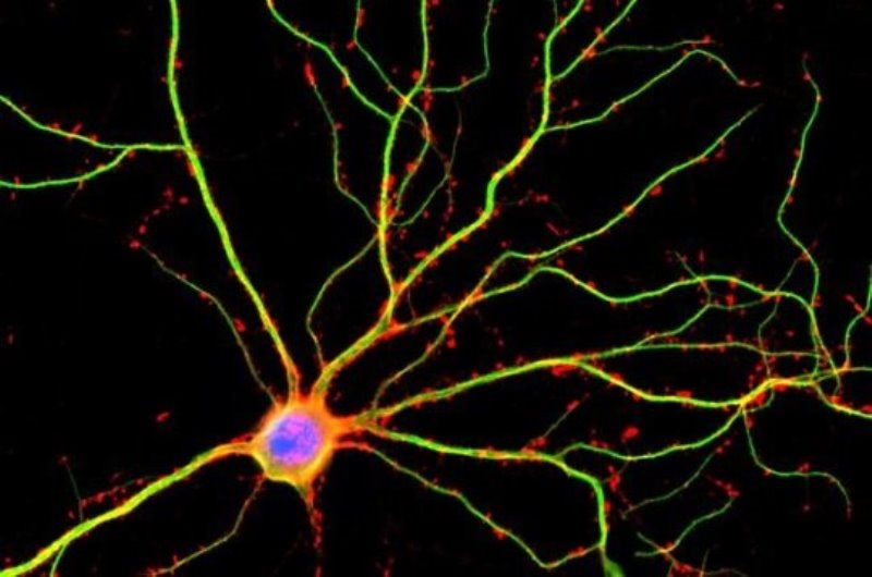 UCLA scientists discovered that dendrites (shown here in green) are not just passive conduits for electrical currents between neurons.