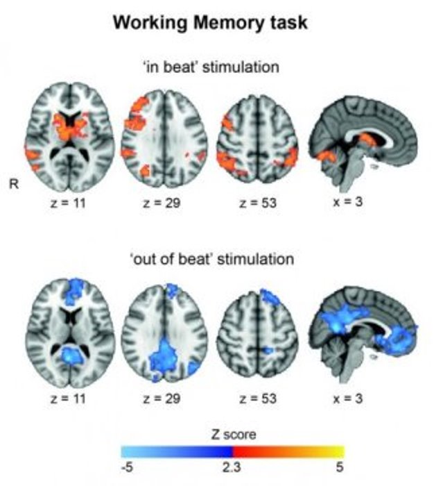 The scans show that stimulation 'in beat' increases brain activity in the regions involved in task performance. On the other hand, stimulation 'out of beat' showed activity in regions usually associated with resting.