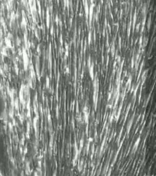 These stem cells are being grown in to muscle cells (myocytes), using a new technique, OPTi-OX, that can grow them in a few days instead of months. The resulting muscle cells are fully functional and contract normally. The OPTi-OX method could be used to make many cell types that haven't been possible to grow before.