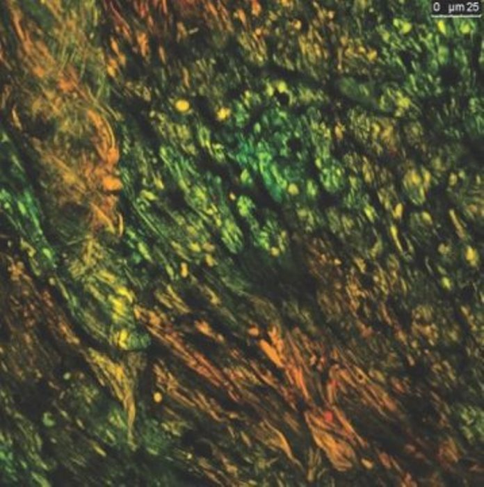 This fluorescent image displays different levels of mitochondrial activity, in red and green, in a mouse heart.