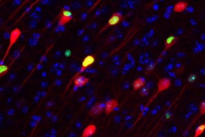 An MIT study of the neural circuits that underlie memory process reveals, for the first time, that memories are formed simultaneously in the hippocampus and the long-term storage location in the brain’s cortex. This image shows memory engram cells (green and red) which are crucial for permanent memory storage in the prefrontal cortex.