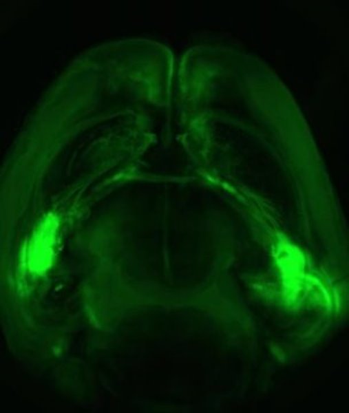 An entire mouse brain viewed from above: Neuronal extensions connect the two amygdalas (brightest green spots on both sides of the brain) with the prefrontal cortex (top).