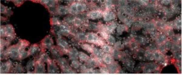 This is a cross section of a mouse liver lobule under a fluorescence microscope. The middle layer reveals an abundance of messenger RNA molecules (white dots) for the gene encoding hepcidin, the iron-regulating hormone.