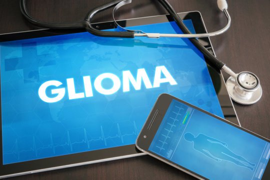 Glioma is one of the most common types of cancerous tumors originating in the brain.