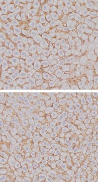 The size of the hepatocytes reaches its maximum at the end of the night (top) and its minimum at the end of the day (bottom), in mice.
