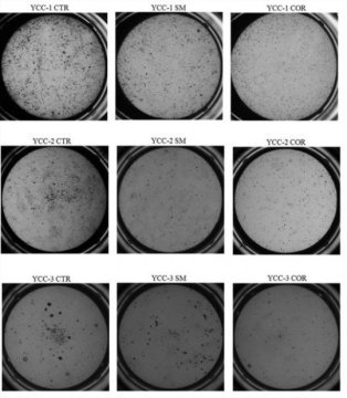 This image illustrates the soft agar colony formation assay, which is a method used to confirm cellular anchorage-independent growth in vitro. The goal of this protocol is to illustrate a stringent method for the detection of the tumorigenic potential of transformed cells and the tumor suppressive effects of proteins on transformed cells.