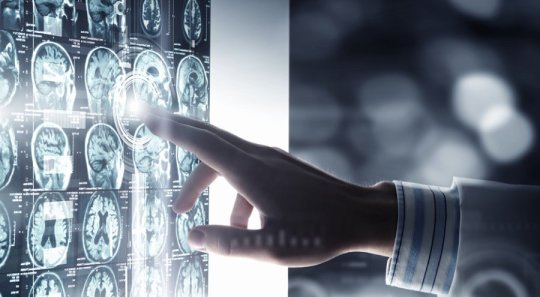 In this study, 61 students had MRI scans taken of their brains after filling out a survey designed to measure their ability to tolerate the uncertainty of future negative events.
