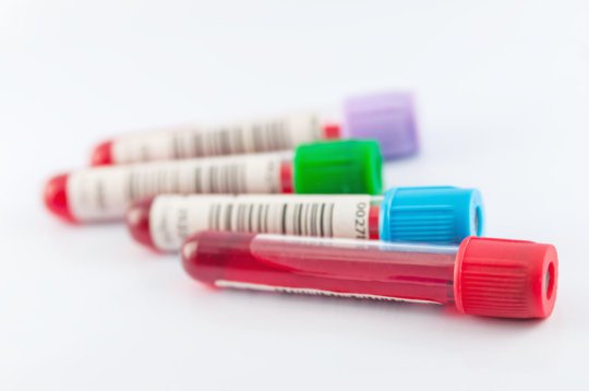 These findings could lead to the first broadly effective ebolavirus therapies and vaccines, say researchers. 
