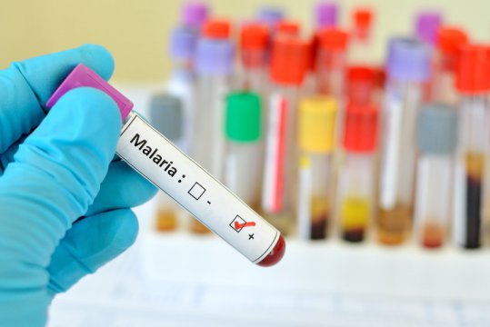 A new study shows that large structural variants in human glycophorin genes, which are unusually common in Africa, are protective against malarial disease.