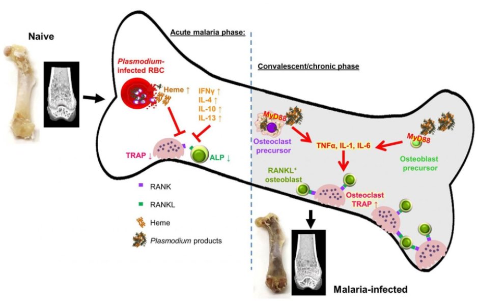 Malaria induces chronic bone loss due to sustained accumulation of Plasmodium products even after the cure of malaria disease.