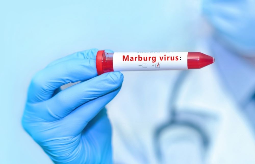 WHO has pledged support for Rwanda's efforts to control Marburg virus disease.