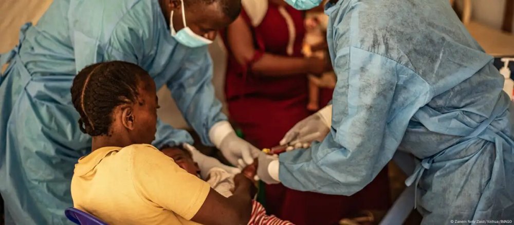 The disease, which surfaced in late October 2024, primarily affects malnourished children under five years old and presents symptoms such as fever, headache, cough, runny nose, and body ache.