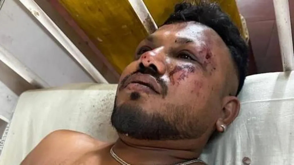 Vishwash Kumar Ramesh, a 40-year-old British national seated in 11A aboard Air India Flight AI171, lived to recount the harrowing moments when the Boeing 787-8 Dreamliner crashed just seconds after takeoff from Ahmedabad’s Sardar Vallabhbhai Patel International Airport.