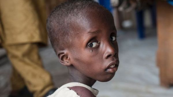 Unicef helps thousands of displaced people at its clinics in Borno state
