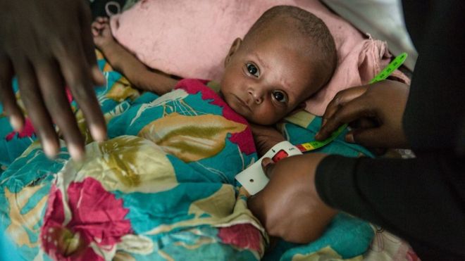 Drought and conflict are to blame for the crisis in East Africa, the DEC said.