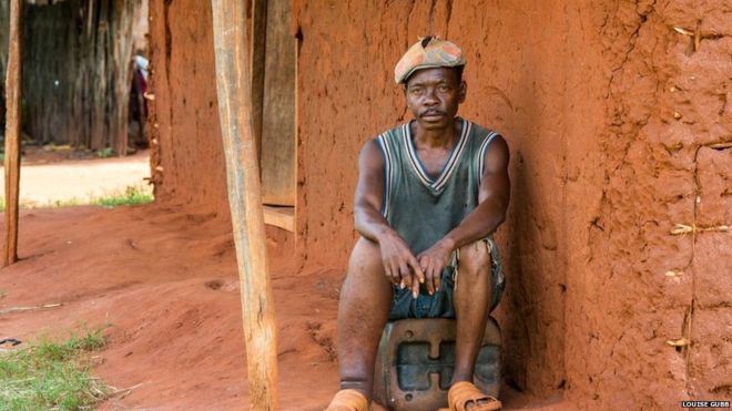 More people are now getting treatment for lymphatic filariasis which makes limbs swell